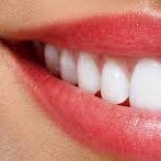 Pembe Estetik (Diş Eti Estetiği) Nedir?