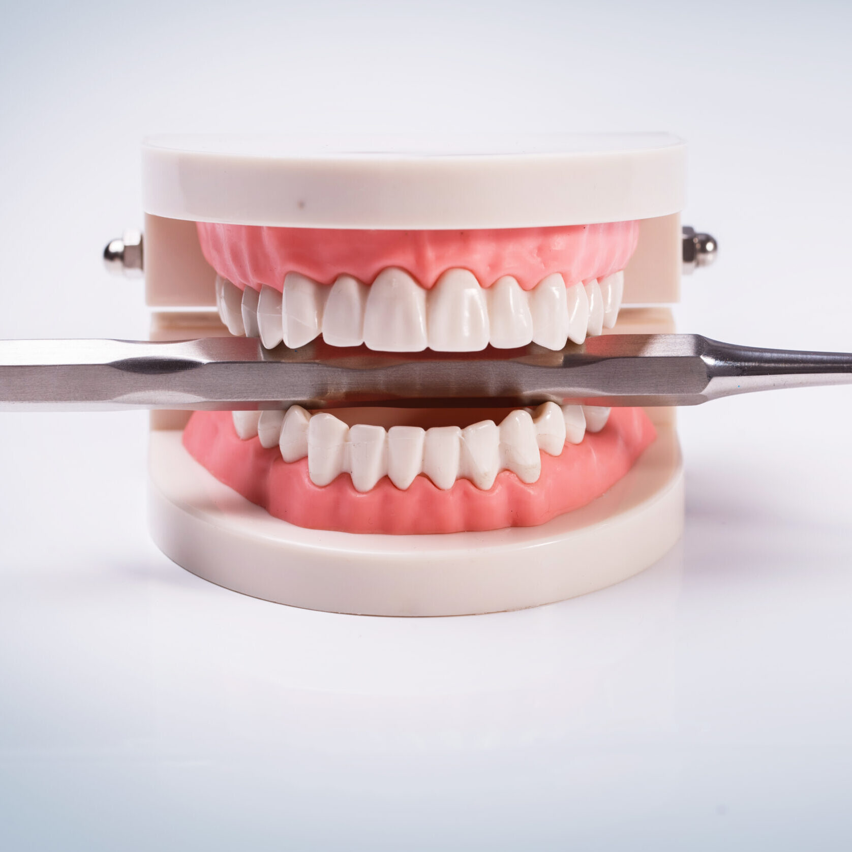 Bio Diş Dolgusu Nedir?